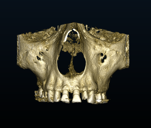 cbct