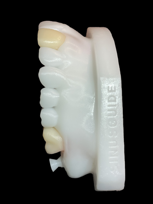 Pedodontic - Pediatric Endodontics - Image 4